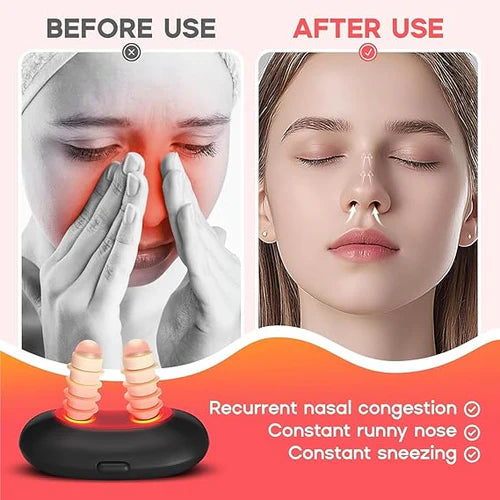 URBANLO™ RespiRelief Nasal Therapy Instrument